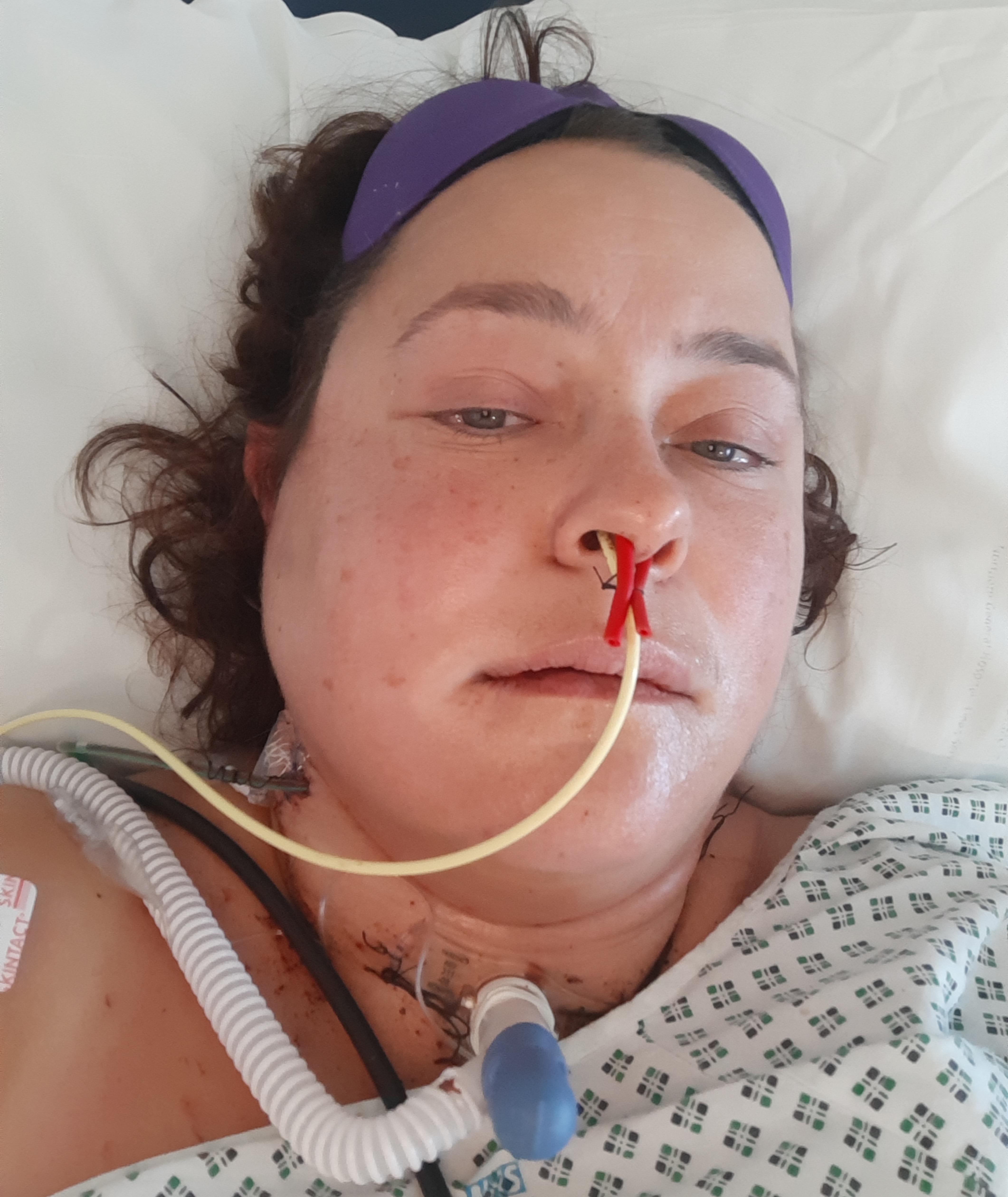 Gill during surgery
