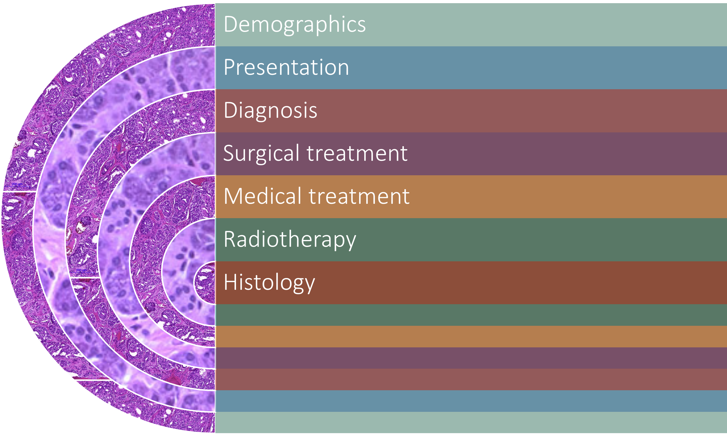 Diagram Salivary Gland Cancer